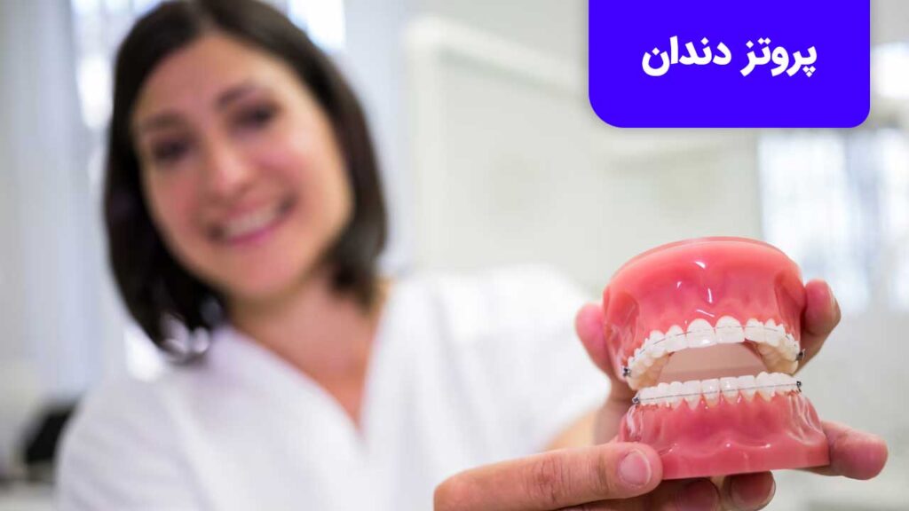 پروتز دندان برای کسانی مناسب است که به هر دلیلی دندان خود را از دست داده اند