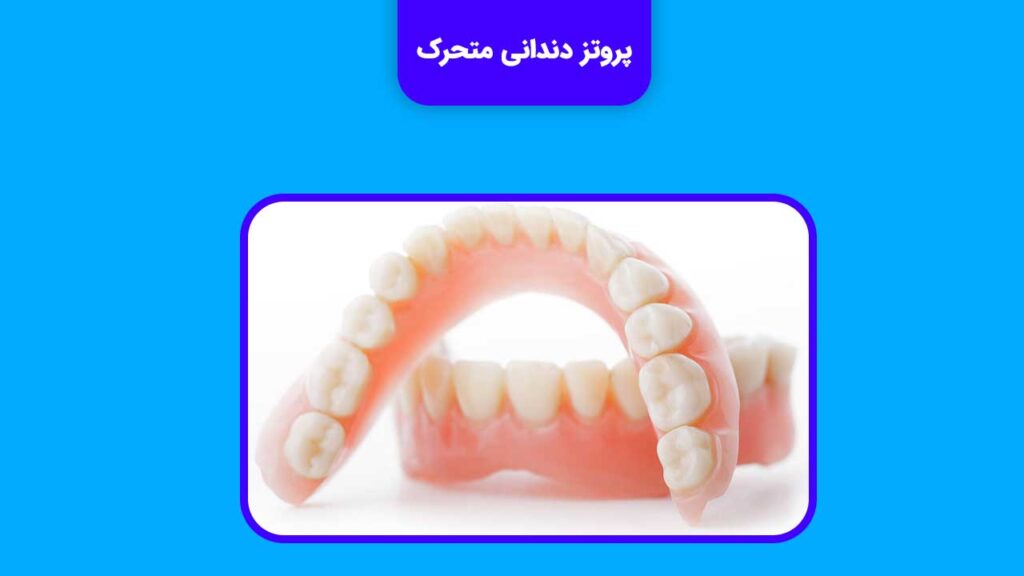 پروتز دندان متحرک یکی از روش های پروتز دندان می باشد