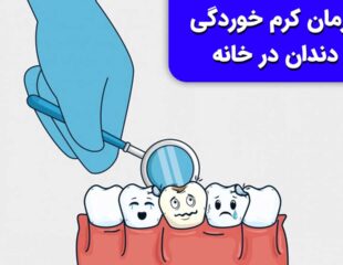 درمان کرم خوردگی دندان در خانه